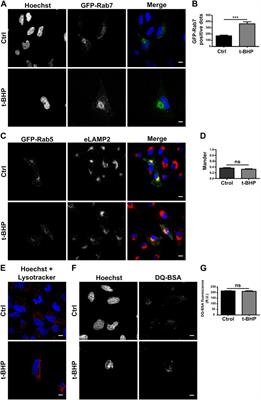 Staphylococcus aureus phagocytosis is affected by senescence